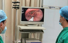 Người đàn ông 56 tuổi bị kiến chui vào thanh quản từ 1 việc không ngờ tới