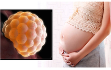 Người phụ nữ 49 tuổi tưởng tiền mãn kinh, bất ngờ phát hiện chửa trứng từ dấu hiệu nhiều chị em dễ bỏ qua