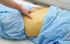 Người phụ nữ 62 tuổi men gan tăng gấp 30 lần, suy gan cấp vì một sai lầm nhiều người Việt mắc phải
