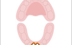 Thứ tự mọc răng sữa của bé mẹ cần biết