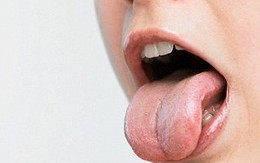 Nhận biết tình trạng sức khoẻ qua lưỡi