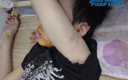 Bé trai 14 tuổi bị hành hung đã bình phục