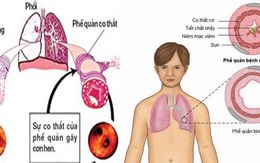 Bệnh phổi tắc nghẽn mạn tính - một nguyên nhân gây tử vong hàng đầu