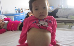 Xót xa bé 4 tuổi “bụng căng tròn” thiếu 10 triệu đồng cắt lá lách