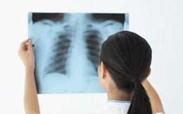 Gần 5% người Việt mắc bệnh phổi tắc nghẽn mạn tính