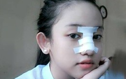Nữ sinh vụ Midu - Phan Thành: Ba mẹ cho tiền sửa mũi 2 lần