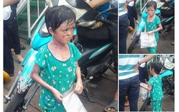 Sự thật câu chuyện bé gái "bị tạt nước sôi gây lở loét để bắt đi ăn xin ở An Giang"