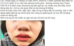 Cô gái trẻ đăng tin "truy tìm" tài xế gây tai nạn, vờ đưa nạn nhân đi viện rồi... bỏ chạy