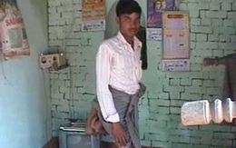 Chàng trai có hai chân thừa bị hắt hủi như quỷ dữ