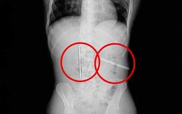 Nuốt lưỡi cưa và đinh để cá cược