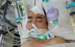Nguyễn Hoàng vẫn hôn mê sau một tuần phẫu thuật