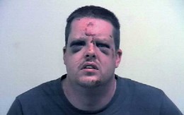 Định giở trò cưỡng hiếp nhưng lại bị đánh tím mặt