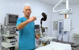 Hoảng hồn với túi tóc khổng lồ trong bụng bé gái