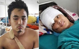 Động đất Nepal: Cặp đôi rơi từ tháp 60 m sống sót kỳ diệu