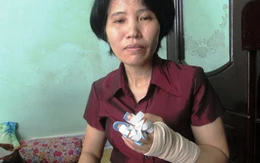 Người phụ nữ cầm dao chém đứt lìa 2 ngón tay hàng xóm