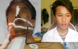 Thiếu niên 15 tuổi đâm trọng thương xe ôm bị bắt khi trở về nhà