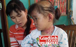 Xót xa tình cảnh bé gái mắc bệnh khiến toàn thân tróc vảy, lột da theo mùa