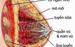 Cách ngừa viêm tuyến vú khi cho con bú