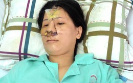 12 giờ "giải cứu nhan sắc" của bác sĩ với người phụ nữ bị nát mặt vì nổ bom