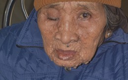 Gần 10 triệu đồng đến với cụ bà mù mắt lay lắt trong mái tranh nghèo