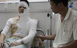 Nam sinh viên Hà Nội bị tạt axit lúc nửa đêm