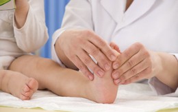 Nhức mỏi chân ở trẻ em là bệnh gì?