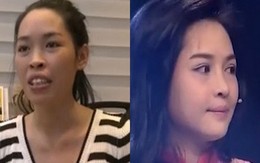 Kỳ tích trước và sau của “cô gái thẩm mỹ” ở Nam Định