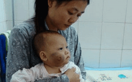 Gặp lại bé Như Ý – nạn nhân bị cha mẹ bạo hành từng gây phẫn nộ dư luận