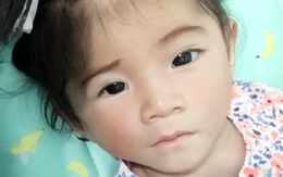 Bé gái Lào Cai 14 tháng tuổi chỉ nặng 3,5 kg hiện đã được 6 kg và hồng hào hơn
