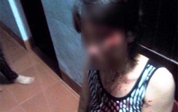 Bị chồng đánh dã man, một phụ nữ bị sảy thai