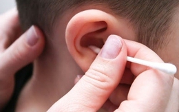 Tác hại của việc lạm dụng tăm bông ngoáy tai cho trẻ