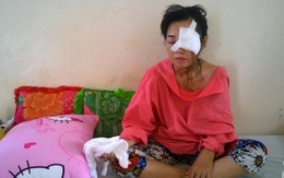 Vợ bị chồng cũ thuê người tạt axit: “Thà anh ta cứ đánh chửi tôi thế nào cũng được..."