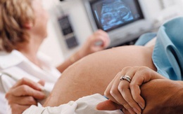 Tập huấn siêu âm chẩn đoán sớm hội chứng đầu nhỏ ở thai nhi