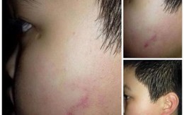 Đình chỉ cô giáo cho 42 học sinh tát bạn cùng lớp