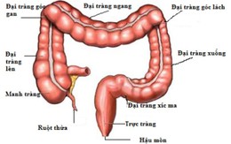 Hội thảo về phát hiện sớm ung thư đại trực tràng?