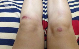 Chồng “tung chưởng” đạp 3 tên cướp túi của vợ khi đang đi mua quà Valentine