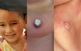 Nguy hiểm từ việc bấm lỗ tai cho con trẻ mà cha mẹ không ngờ tới