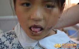 Xót xa hình ảnh bé gái 10 tuổi bị mẹ lấy kìm cắt lưỡi, cắt tai