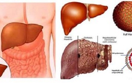 Cách phát hiện mắc bệnh gan nhanh chóng chỉ sau 10 phút