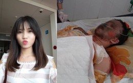 Cả làng thay phiên nhau chăm mẹ con cô gái bị bỏng toàn thân