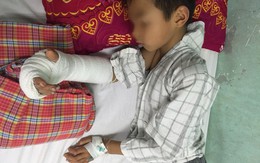 Đùa nghịch, anh họ 14 tuổi chém gần đứt lìa tay em trai