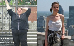 Câu chuyện kinh ngạc của cô gái giảm từ 187kg xuống còn 49kg và hậu quả đáng tiếc