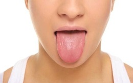 Buổi sáng ngủ dậy mà có biểu hiện này thì phải đi khám ngay