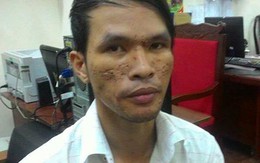 Bé trai Campuchia từng gọi kẻ hành hạ là cha