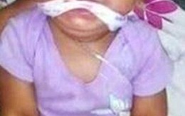 Bé gái 9 tháng tuổi bị mẹ và giúp việc bịt miệng, trói tay rồi đăng lên Facebook