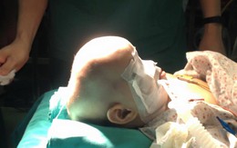 Bv Xanh Pôn: Phẫu thuật thành công hộp sọ biến dạng hình thuyền hiếm gặp cho bé 11 tháng tuổi
