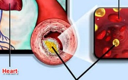 Kẻ thù âm thầm đang giết chết nhiều người trẻ tuổi