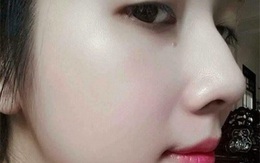 Dùng 2 viên này mỗi ngày, cả đời không cần mua mỹ phẩm, lỗ chân lông được se khít 100%