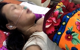 Chồng đánh vợ tổn thương sọ não, nhập viện cấp cứu