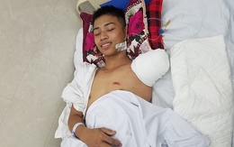 Chàng trai mất tay vì cứu bạn: "Việc mình làm nhỏ thôi"